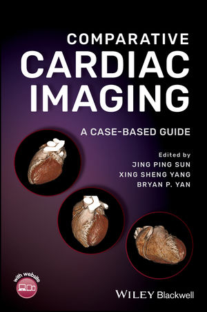 [PDF] Comparative Cardiac Imaging: A Case‐Based Guide (2018) by Jing Ping Sun (Editor), Xing Sheng Yang (Editor), Bryan P. Yan (Editor)