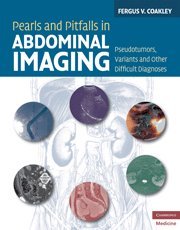 [PDF] Pearls and Pitfalls in Abdominal Imaging Pseudotumors, Variants and Other Difficult Diagnoses (Cambridge Medicine) 1st Edition (2011) by Fergus V. Coakley