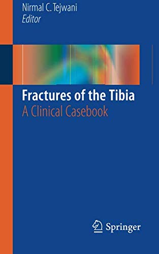 [PDF] Fractures of the Tibia: A Clinical Casebook (2015) by Nirmal C. Tejwani, MD