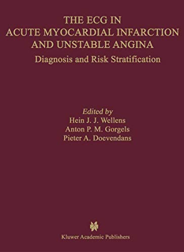 [PDF] The ECG in Acute Myocardial Infarction and Unstable Angina: Diagnosis and Risk Stratification (Developments in Cardiovascular Medicine Book 245) (2002) by Hein J.J. Wellens