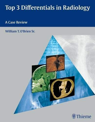 [PDF] Top 3 Differentials in Radiology: A Case Review 1st Edition (2009) by William T. O’Brien