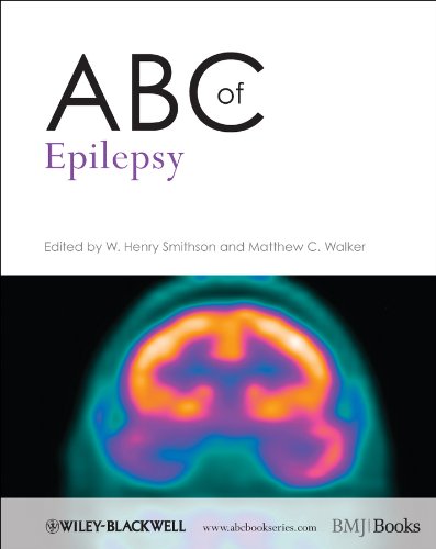 [PDF] ABC of Epilepsy (2012) by W. Henry Smithson