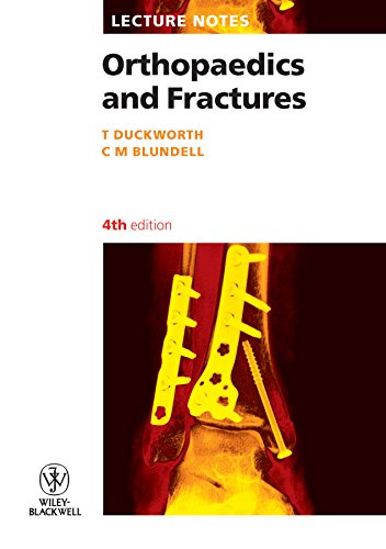 [PDF] Lecture Notes Orthopaedics and Fractures, 4th Edition (2010) by T. Duckworth