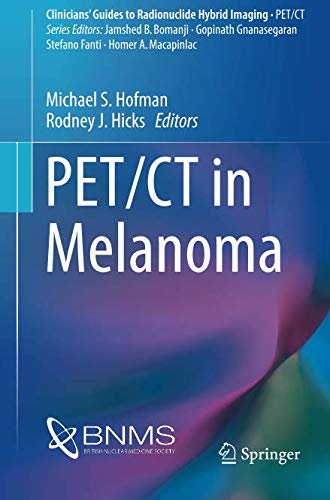 [PDF] PET/CT in Melanoma (Clinicians’ Guides to Radionuclide Hybrid Imaging) (2017) by Michael S. Hofman