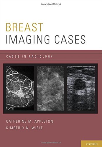 [PDF] Breast Imaging (2011) by Catherine M. Appleton