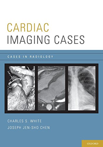 [PDF] Cardiac Imaging (Cases in Radiology) 1st Edition (2010) by Charles S. White