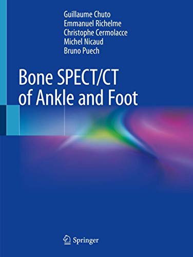 [PDF] Bone SPECT/CT of Ankle and Foot 1sy Edition (2018) by Guillaume Chuto