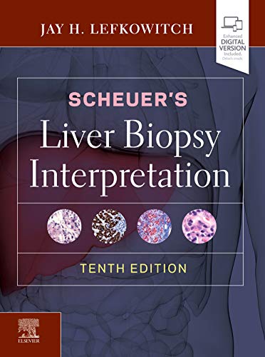 [PDF] Scheuer’s Liver Biopsy Interpretation 10th Edition (2020) by Jay H. Lefkowitch MD