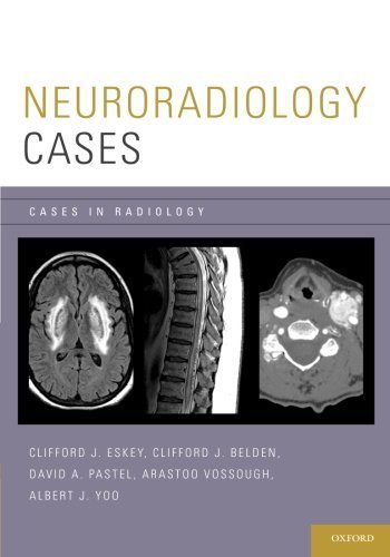 [PDF] Neuroradiology (Cases in Radiology) (2012) by Clifford J. Eskey