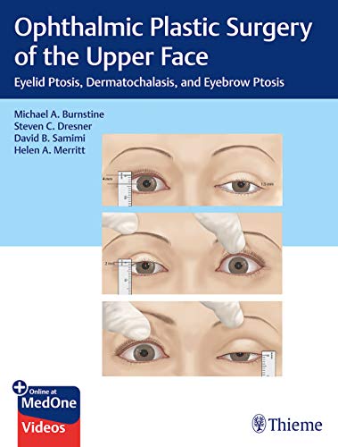 [PDF] Ophthalmic Plastic Surgery of the Upper Face (Eyelid Ptosis, Dermatochalasis, and Eyebrow Ptosis) 1st Edition (2019) by Michael A. Burnstine