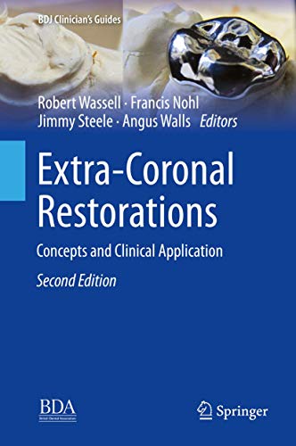 [PDF] Extra-Coronal Restorations: Concepts and Clinical Application (BDJ Clinician’s Guides) 2019 Edition