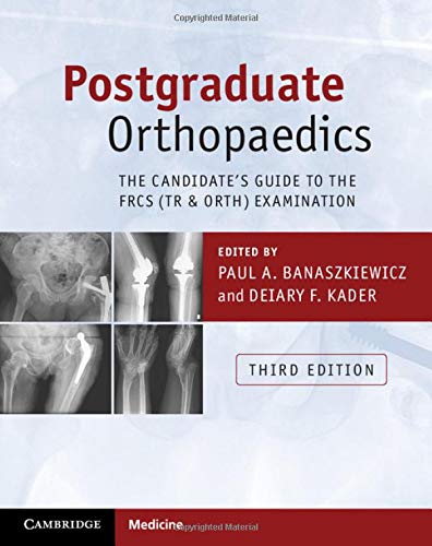 [PDF] Postgraduate Orthopaedics The Candidate’s Guide to the FRCS(Tr & Orth) Examination 3rd Edition (2017) by Paul A. Banaszkiewicz