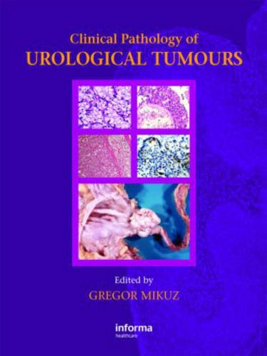 [PDF] Clinical Pathology of Urological Tumours 1st Edition (2007) by Gregor Mikuz