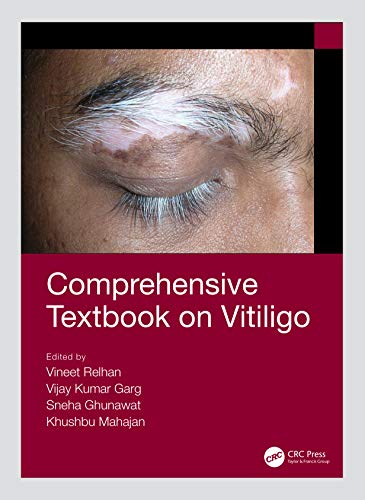 [PDF] Comprehensive Textbook on Vitiligo 1st Edition (2020) by Vineet Relhan