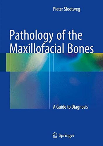 [PDF] Pathology of the Maxillofacial Bones – A Guide to Diagnosis 1st Edition (2015) by Pieter Slootweg