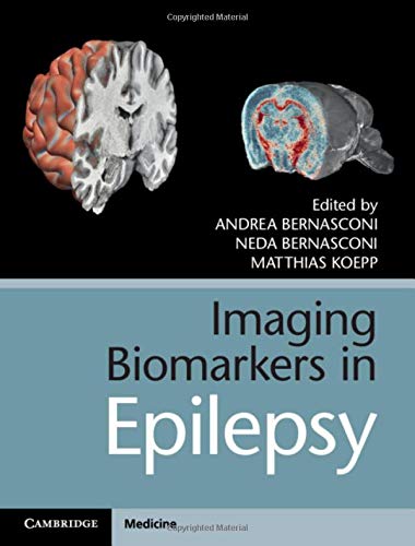 [PDF] Imaging Biomarkers in Epilepsy 1st Edition (2019) by Andrea Bernasconi