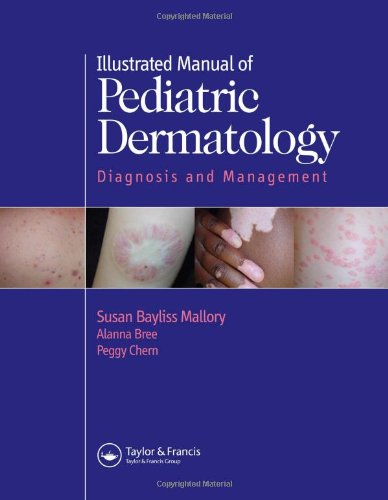 [PDF] Illustrated Manual of Pediatric Dermatology Diagnosis and Management, 2nd Edition (2005) by Susan Mallory