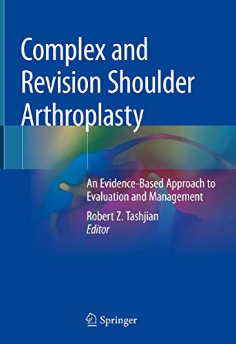 [PDF] Complex and Revision Shoulder Arthroplasty: An Evidence-Based Approach to Evaluation and Management (2019) by Robert Z. Tashjian