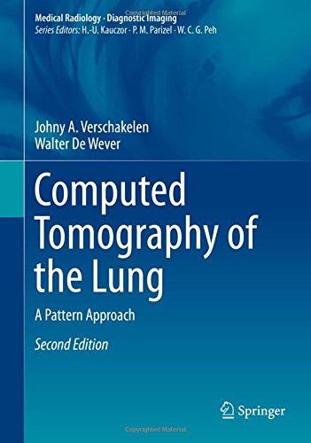 [PDF] Computed Tomography of the Lung: A Pattern Approach 2nd Edition (2018) by Johny A. Verschakelen