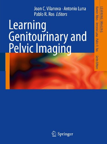 [PDF] Learning Genitourinary and Pelvic Imaging (2012) by Joan C. Vilanova