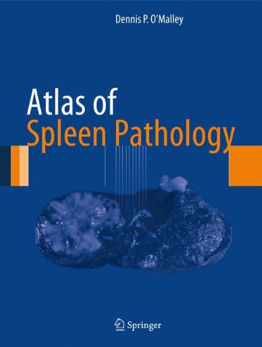 [PDF] Atlas of Spleen Pathology (2012) by Dennis P. O’Malley