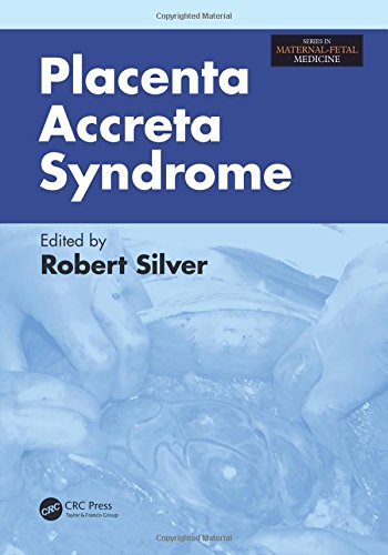 [PDF] Placenta Accreta Syndrome (2017) by Robert M. Silver