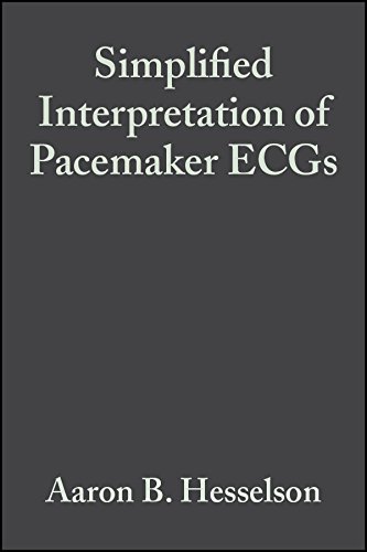 [PDF] Simplified Interpretation of Pacemaker ECGs – An Introduction (2003) by Aaron B. Hesselson