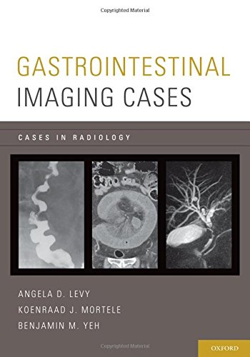 [PDF] Gastrointestinal Imaging Cases 1st Edition (2013) by Angela D. Levy