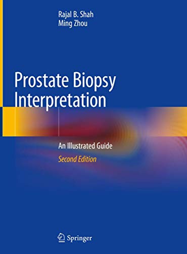 [PDF] Prostate Biopsy Interpretation: An Illustrated Guide 2019 Edition