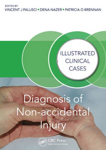 [PDF] Diagnosis of Non-accidental Injury: Illustrated Clinical Cases (2015) by Vincent J. Palusci