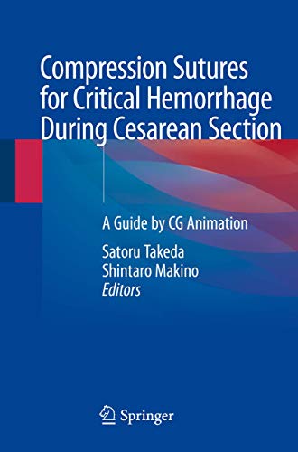 [PDF] Compression Sutures for Critical Hemorrhage During Cesarean Section: A Guide by CG Animation 1st Edition (2020)