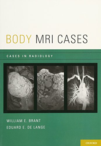 [PDF] Body MRI Cases (2013) by William Brant