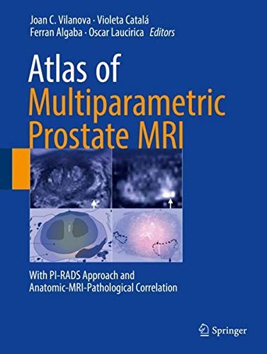 [PDF] Atlas of Multiparametric Prostate MRI: With PI-RADS Approach and Anatomic-MRI- Pathological Correlation (2017) by Joan C. Vilanova and Violeta Catalá