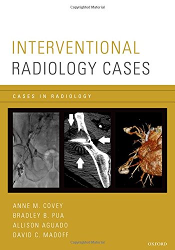 [PDF] Interventional Radiology 1st Edition (2015) by Anne M. Covey