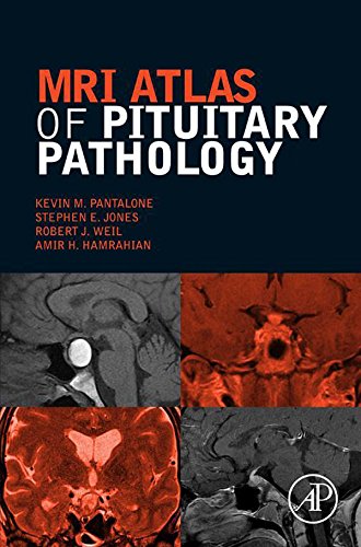 [PDF] MRI Atlas of Pituitary Pathology 1st Edition (2015) by Kevin M. Pantalone