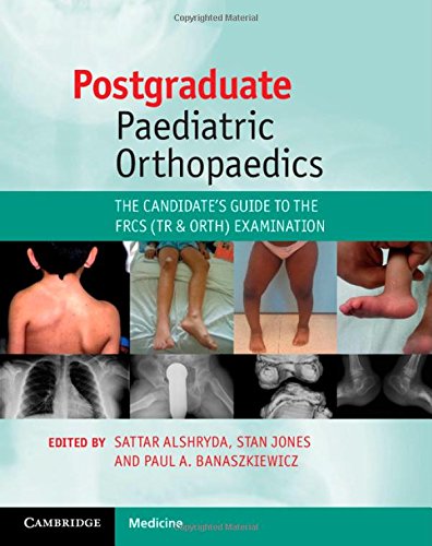 [PDF] Postgraduate Paediatric Orthopaedics: The Candidate’s Guide to the FRCS(Tr & Orth) Examination (2014) by Sattar Alshryda