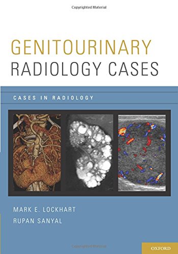 [PDF] Genitourinary Radiology Cases (2014) by Mark E. Lockhart