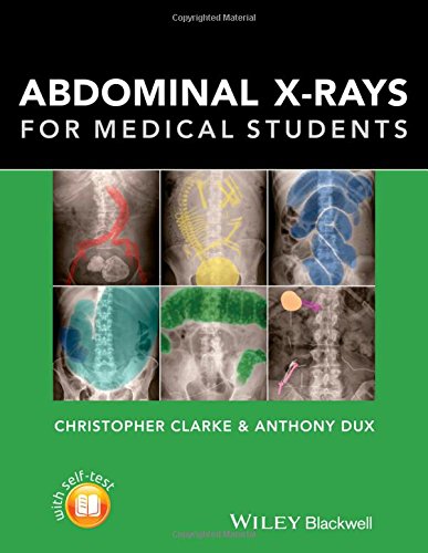 [PDF] Christopher Clarke, Anthony Dux-Abdominal X-rays for Medical Students (2015) by Dr Christopher Clarke