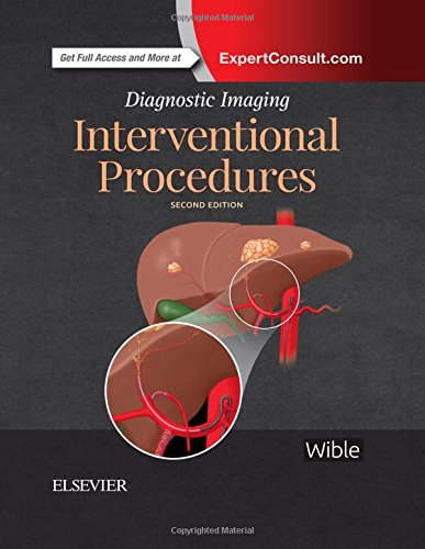 [PDF] Diagnostic Imaging: Interventional Procedures (2017) by Brandt C. Wible