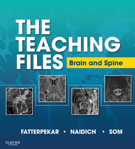 [PDF] The Teaching Files: Brain and Spine 1st Edition (2012) by Girish M. Fatterpekar