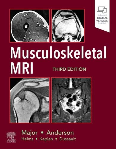 [PDF] Musculoskeletal MRI 3rd Edition (2020) by Nancy M. Major MD