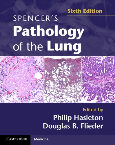 [PDF] Spencer’s Pathology of the Lung, 6th Edition (2013) by Philip Hasleton