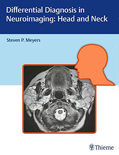 [PDF] Differential Diagnosis in Neuroimaging Head and Neck (2016) by Steven Meyers