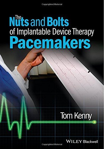 [PDF] The Nuts and Bolts of Implantable Device Therapy Pacemakers (2015) by Tom Kenny