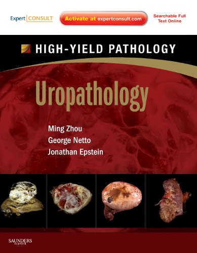 [PDF] Uropathology: A Volume in the High Yield Pathology Series 1st Edition (2012) by Ming Zhou