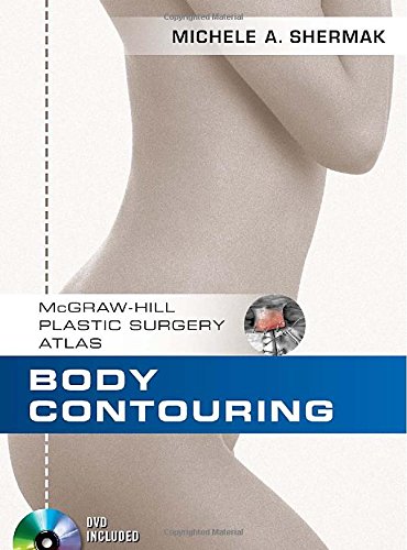 [PDF] Body Contouring, 1st Edition (2010) by Michele A. Shermak, MD