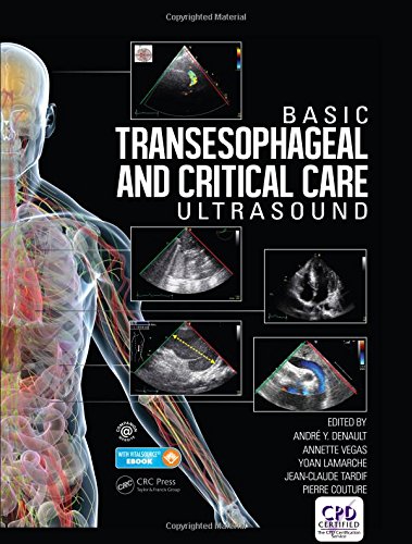 [PDF] Basic Transesophageal and Critical Care Ultrasound (2017) by André Denault and Annette Vegas