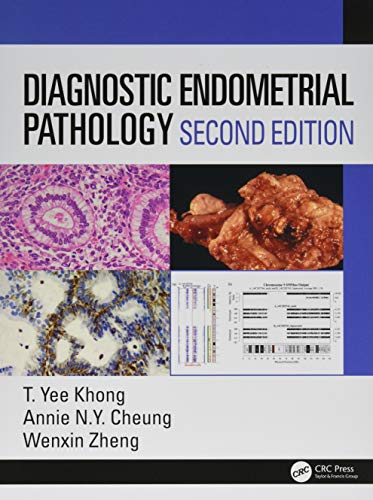 [PDF] Diagnostic Endometrial Pathology 2nd Edition (2019) by Yee Khong