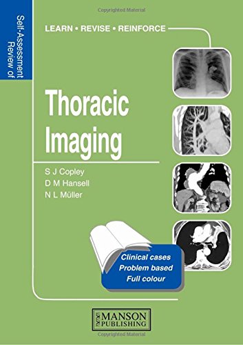 [PDF] Self-assessment Colour Review of Thoracic Imaging (2005) by Sue Copley