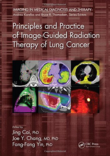 [PDF] Principles and Practice of Image-Guided Radiation Therapy of Lung Cancer (2018) by Jing Cai